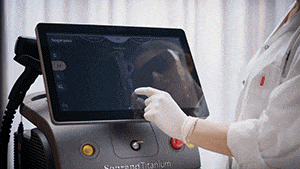 Haarentfernung mit Alma Haarentfernung mit Alma