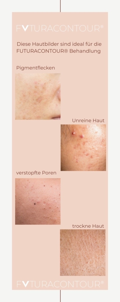 FUTURACONTOUR perfekt geeignet bei diesen Problemzonen