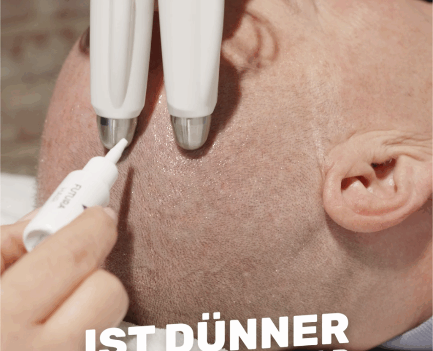 FUTURACONTOUR Kopfbehandlung Futuracontour Haarausfall Behandlung