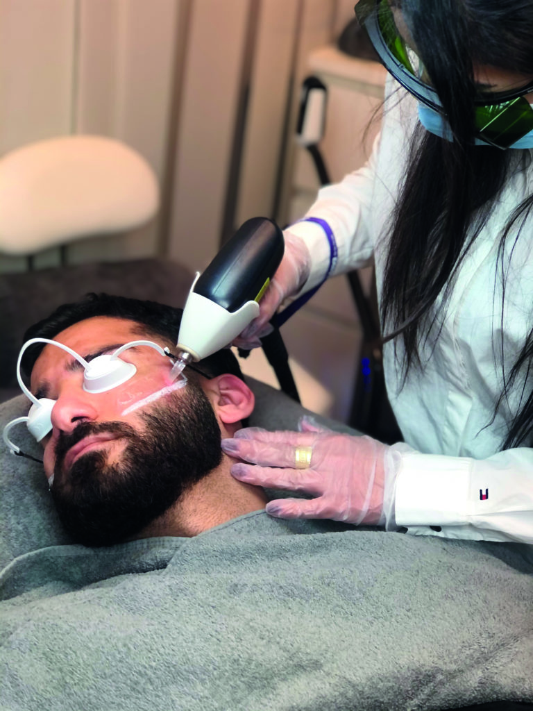 Haarentfernung Bartkontur Haarentfernung im Gesicht eines Mannes