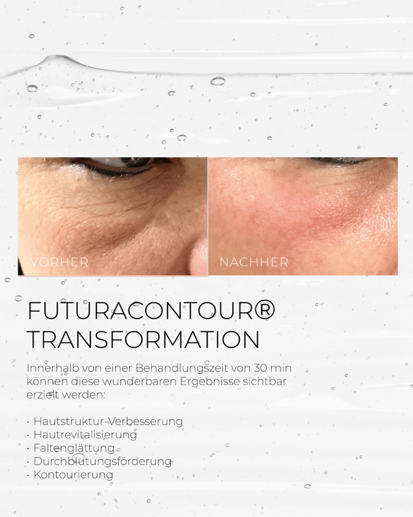 FUTURACONTOUR® Transformation Vorher-Nachher TRANSFORMATION VORHER-NACHHER
