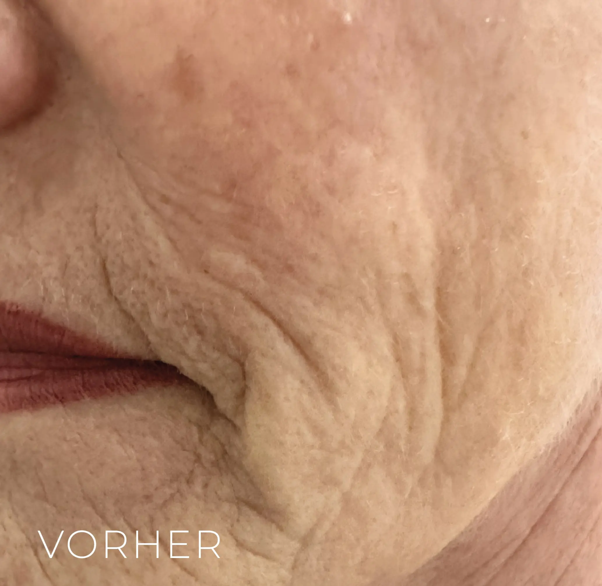 Vorher Gesicht