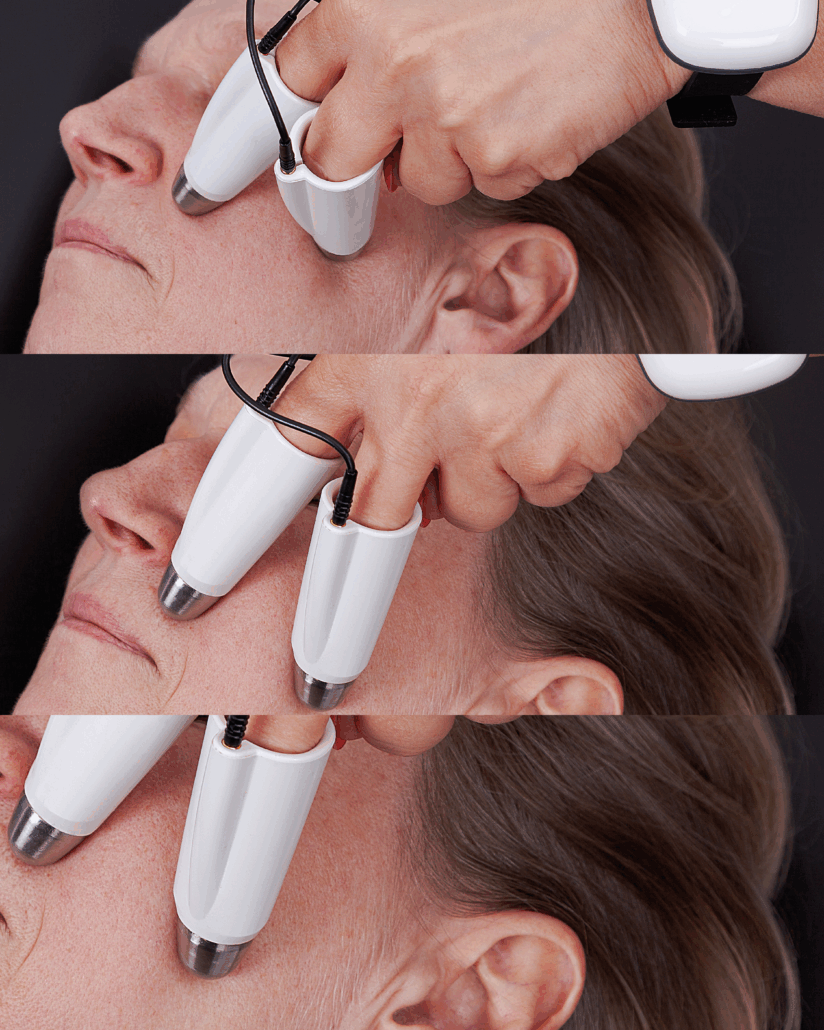 Futuracontour Behandlung Futuracontour Behandlung